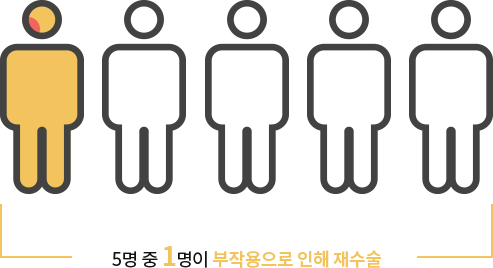 5명 중 1명이 부작용으로 인해 재수술 시행